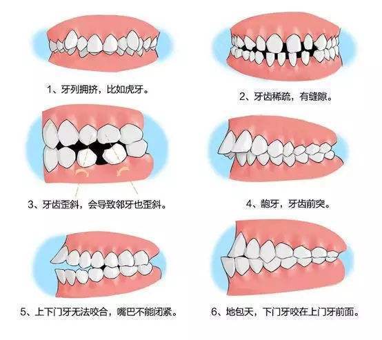 牙齿相学(牙齿相学顺口溜)