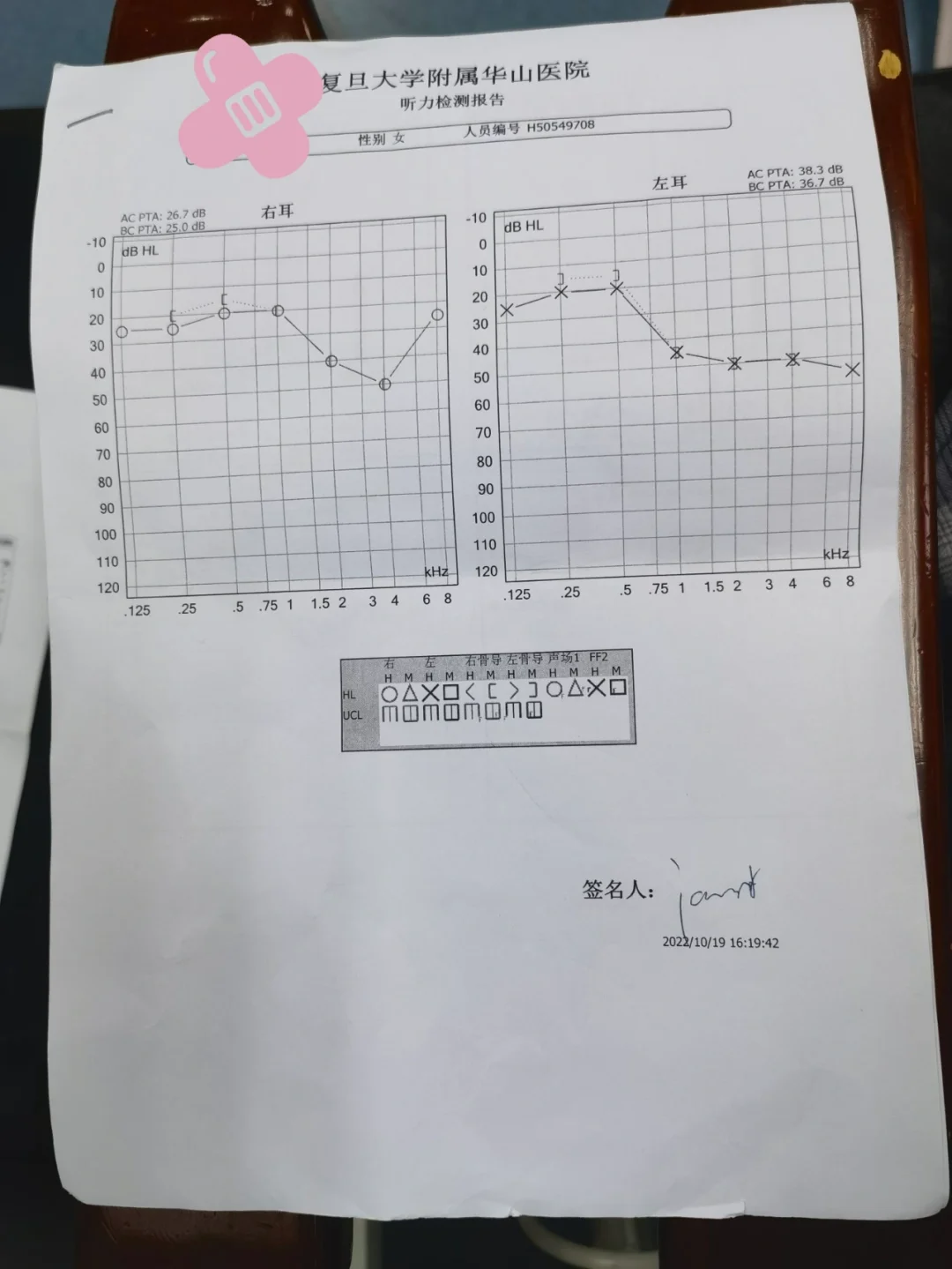 耳鸣测吉凶(卯时耳鸣测吉凶)