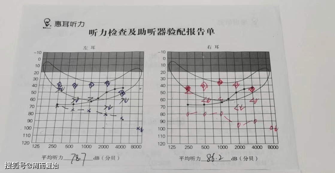 耳鸣测吉凶(左耳耳鸣测吉凶)