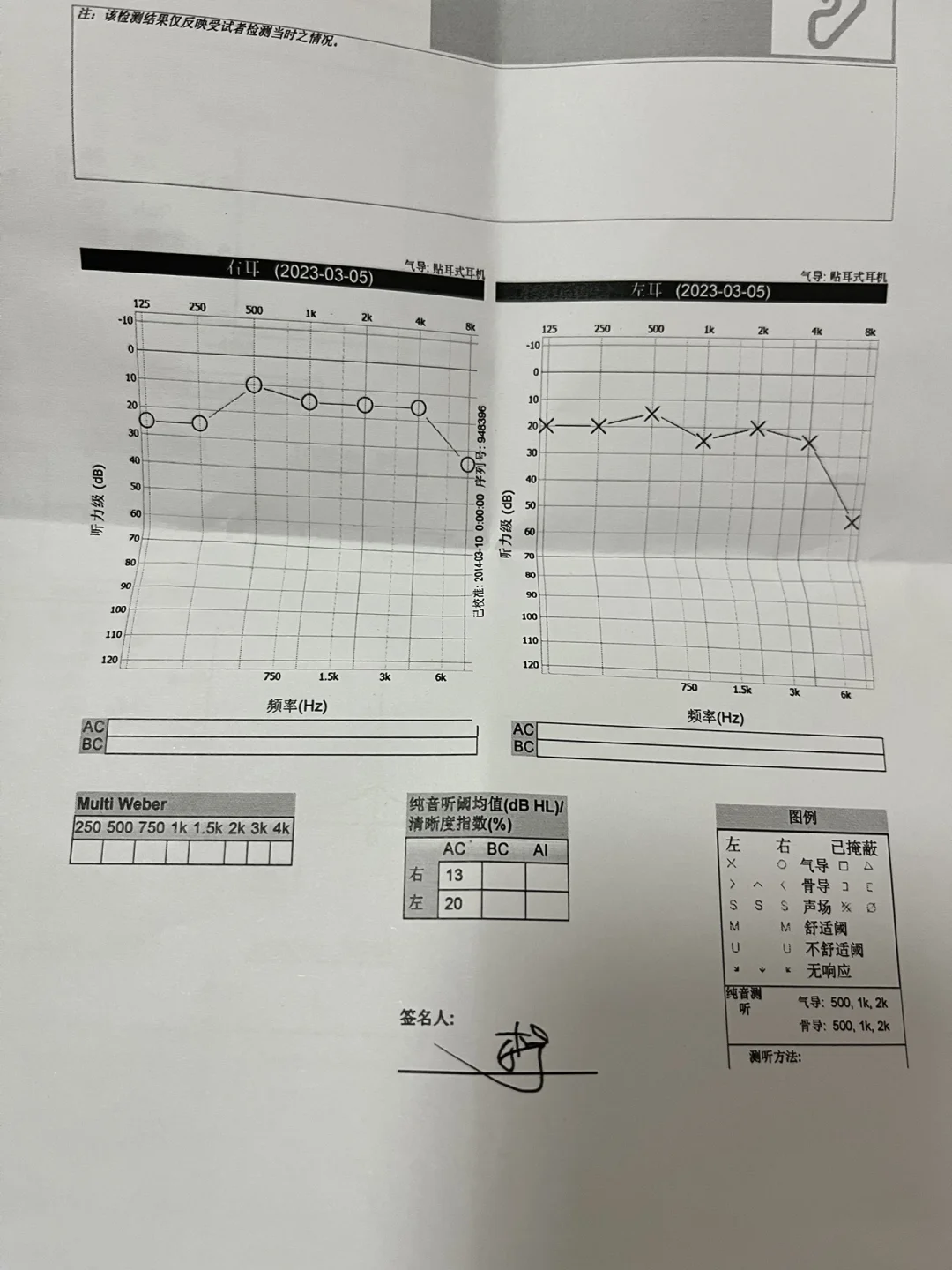 耳鸣测吉凶(晨时左耳鸣测吉凶)