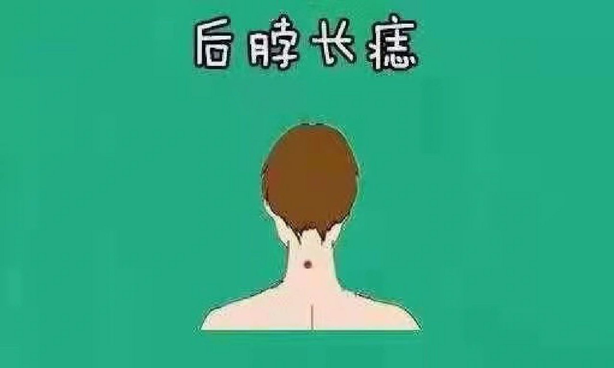 脖子后面有痣的人(脖子后面有痣的人有福吗)